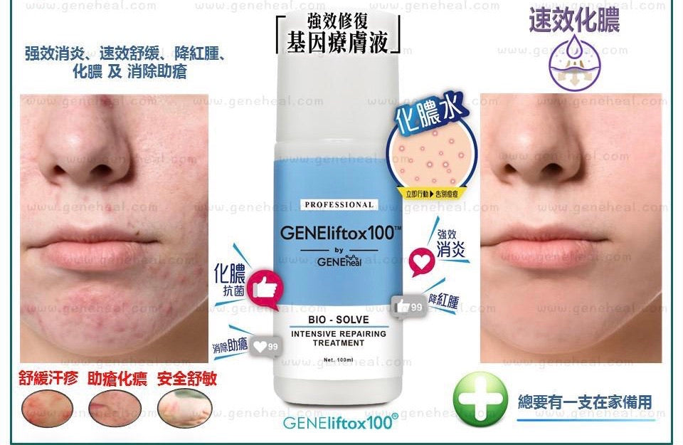 GENEliftox100 - BIO Solve Intensive Repairing Treatment